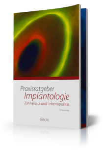 Ratgeber-implantologie